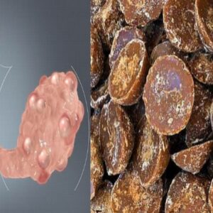 home remedies for pcod pcos