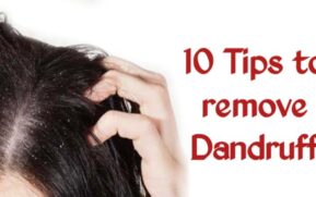 tips to remove dandruff