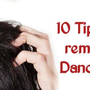 tips to remove dandruff