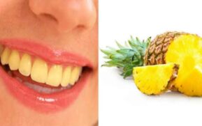 fruits make your teeth whiter