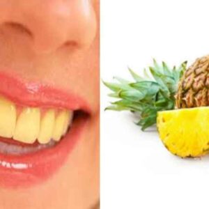 fruits make your teeth whiter