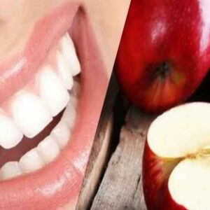 white teeth