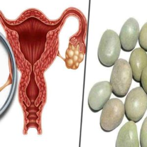 cyst-problem-natural-remedies