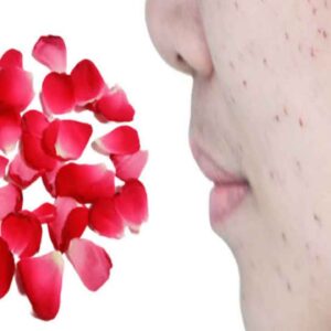 dark spot remedy tips