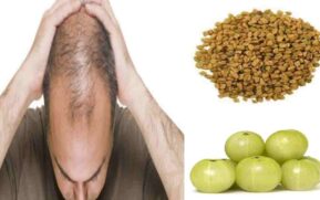 how-can-i-reduce-my-baldness