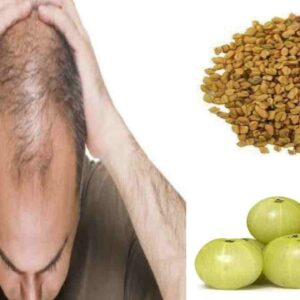 how-can-i-reduce-my-baldness
