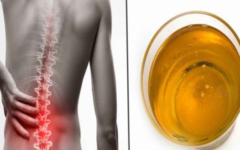 what-to-do-for-back-pain