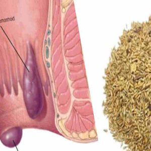 piles-siddha-medicine