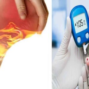 reasons-for-feet-burn