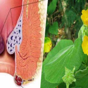 thuthi-cures-piles-problem
