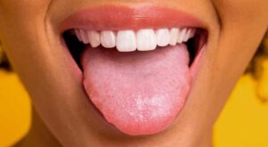 tongue color